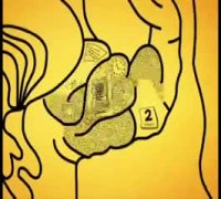 آلزایمر، فراموشی