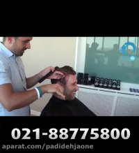 ترمیم مو و کاشت موی طبیعی بدون جراحی