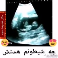 سونوگرافی جنین