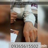 آیا میتوان لکه های پوستی را از بین برد؟