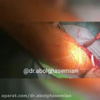 فیلم آسیب نخاعی