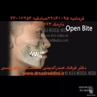تاثیر ارتودنسی بر فک | دکتر فرهاد صدرالدینی