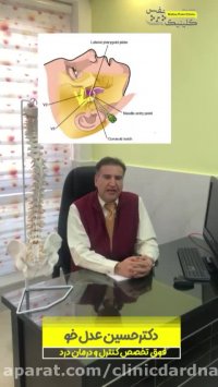 درمان دردهاى عصب سه قلو (نورالژى ترى ژمينال) به روش بلوك عصبى و دستگاه RF