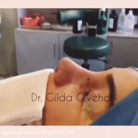 نتیجه عمل جراحی بینی گوشتی بلافاصله بعد از عمل