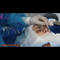 فیلم عمل جراحی بینی ترمیمی (قسمت چهارم)