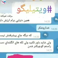 بیماری پوستی پیسی و درمان قطعی این بیماری چیست؟؟