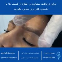 تزریق بوتاکس و رفع چین و چروک