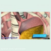 عملکرد معده