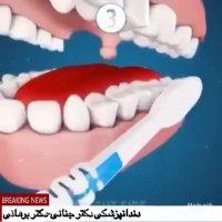 نحوه صحیح مسواک زدن