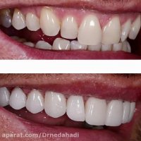 صاحب لبخندی زیبا را بشناسید