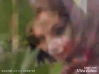 جراحی بینی در تهران