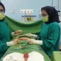 فیلم عمل جراحی هیسترکتومی