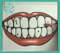 مراقبت از دندان کودکان