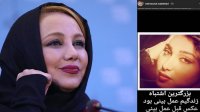اعرافات تلخ بهنوش بختیاری به عمل جراحی بینی