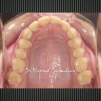 ارتودنسی غرب تهران | دکتر داوودیان