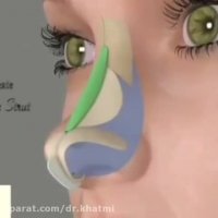 ترمیم عیوب الانف