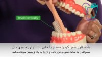 روش مسواک زدن صحیح | سیمادنت