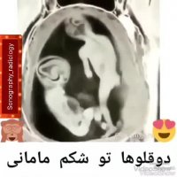 سونوگرافی جنین