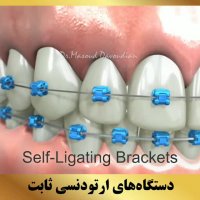 ارتودنسی شمال تهران | متخصص ارتودنسی | دکتر داوودیان