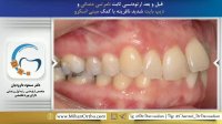 ارتودنسی در تهران | دکتر مسعود داودیان