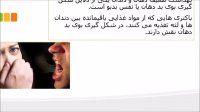 درمان بوی بد دهان