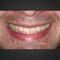 بهترین دکتر ارتودونسی تهران | دکتر داوودیان