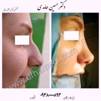 دکتر حسین حامدی |09380000893 ویزیت رایگان