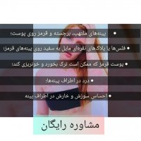 پسوریازیس چیست؟