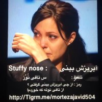 ازچی آبریزش گرفتی ؟