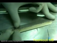 روش جدید در جراحی افتادگی پلک | پروفسور کشکولی