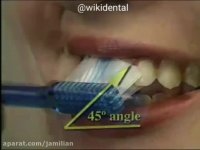 روش صحیح مسواک زدن