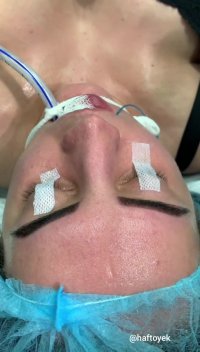 شرایط اتاق عمل جراحی بینی