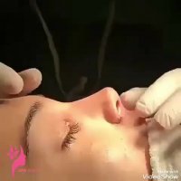 دکتر حسین حامدی عمل بینی در مشهد