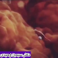 واكنش ناخواسته ي سيستم ايمني بدن بانوان به ورود اسپرم