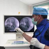 دردهای عصب سه قلو