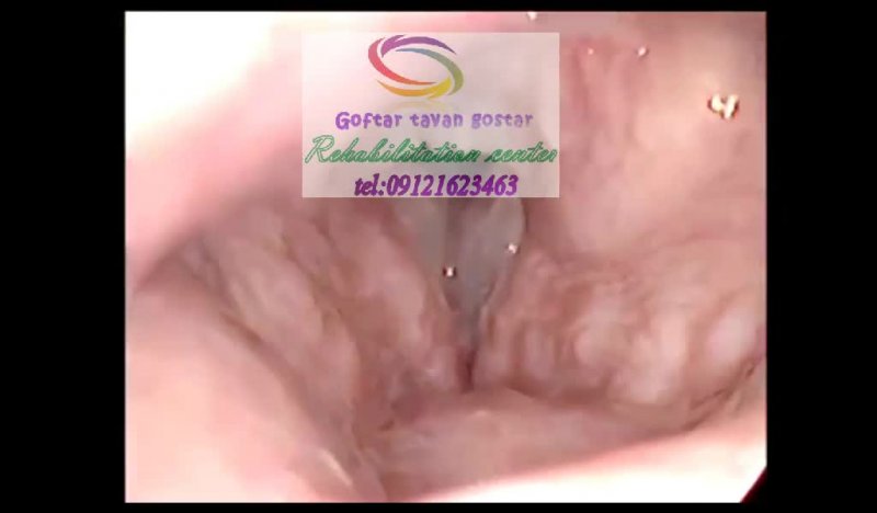 گفتاردرمانی در البرز   09121623463  عظیمیه میدان بهارستان خیابان لاله 1