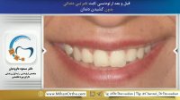 دکتر ارتودنسی در تهران