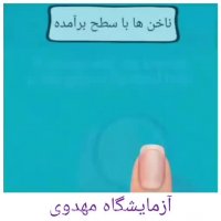 تشخیص بیماری از روی ناخن