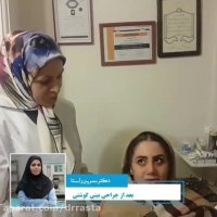 رضایت بیمار بعد از عمل بینی