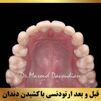 دکتر ارتودنسی در تهران | دکتر داودیان