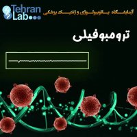 درباره ترومبوفیلی چه میدانید؟