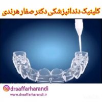 انیمیشن بلیچینگ دندان