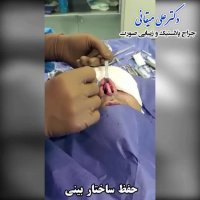 فیلم حفظ ساختار بینی