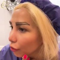 کلینیک کاشت ابرو