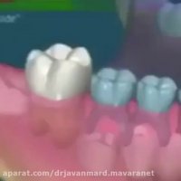 اهمیت دندان های شیری در رویش صحیح دندان های دائمی