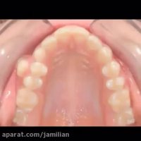 نحوه درمان ارتودنسی