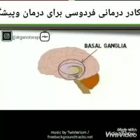 عوامل به وجود آمدن پارکینسون چیست؟