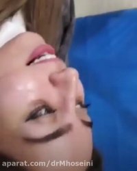 نمونه جراحی بینی توسط دکترحسینی