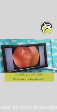 اهمیت بکارگیری آندوسکوپ های با دقت بالا و باکیفیت