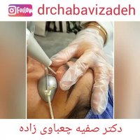 رفع گزانتوم پلک با لیزرco2 | دکتر صفیه چعباوی زاده